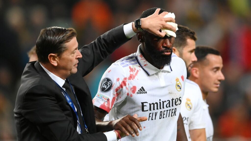 รูดิเกอร์คิ้วแตก