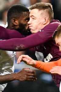 รูดิเกอร์คิ้วแตก